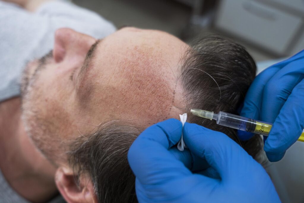 Hair Transplant Procedure